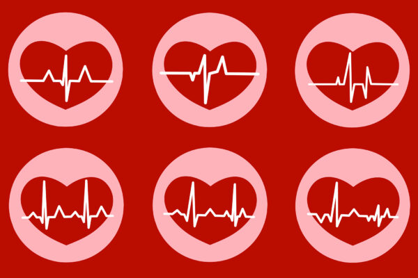 Heart Rate Variability