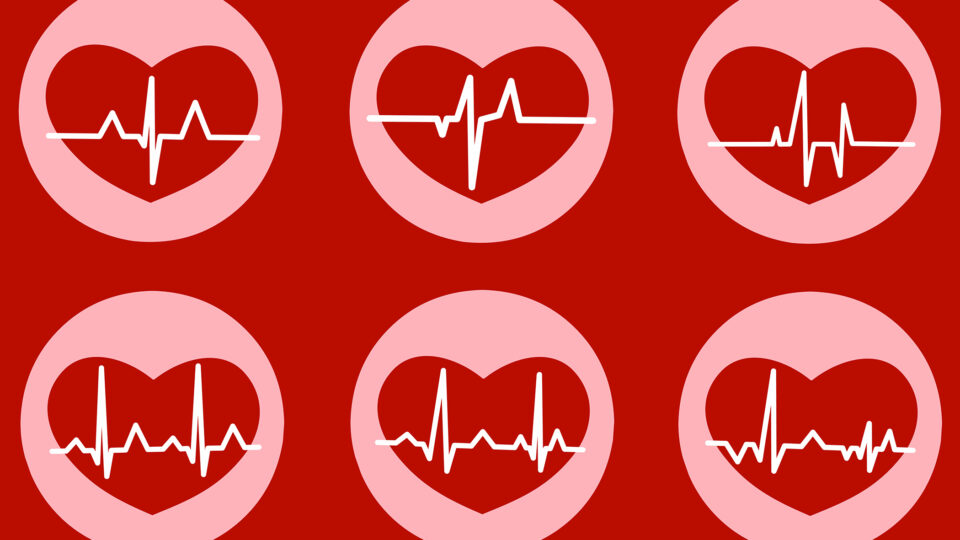 Heart Rate Variability